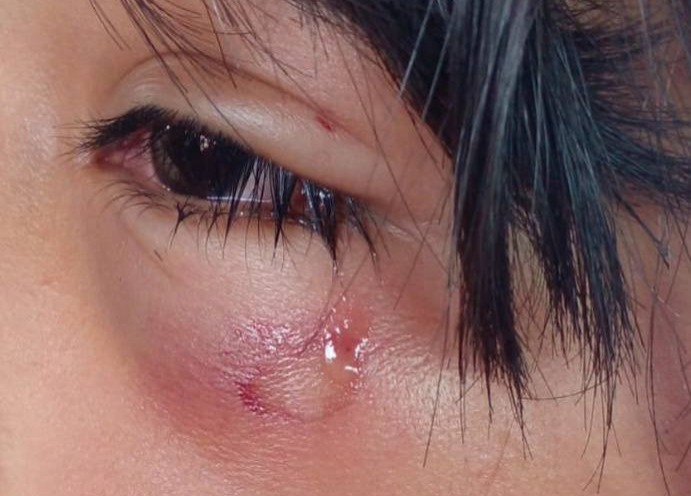 Denuncian a hombre por agredir, acosar e intentar atropellar a su expareja