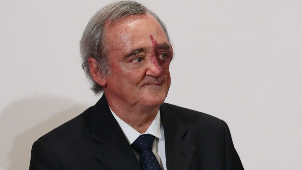 Equipo español logra eliminar cáncer de páncreas en ratones