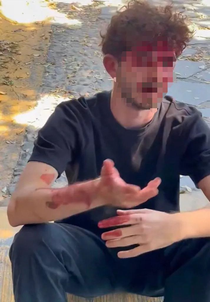 Agreden a joven italiano durante funeral de “El Mencho” en Zapopan